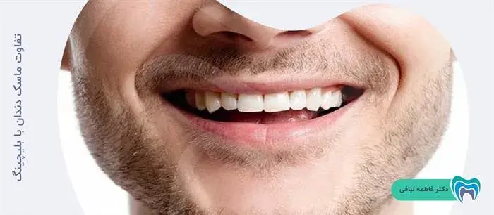 تفاوت ماسک دندان با بلیچینگ 