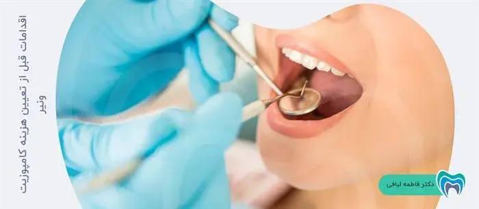 قبل از تعیین هزینه کامپوزیت دندان چه اقداماتی انجام می شوند؟