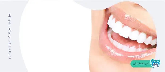 ایمپلنت دندان بدون جراحی چه مزایایی دارد؟