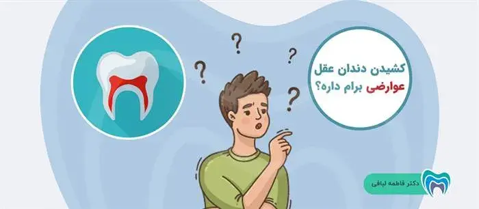آیا کشیدن دندان عقل عوارض دارد؟