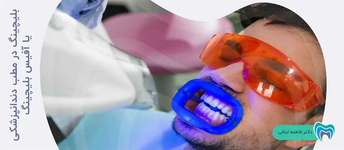 بلیچینگ در مطب دندانپزشکی یا آفیس بلیچینگ