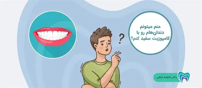 آیا شما هم می‌توانید دندان‌هایتان را با کامپوزیت سفید کنید؟