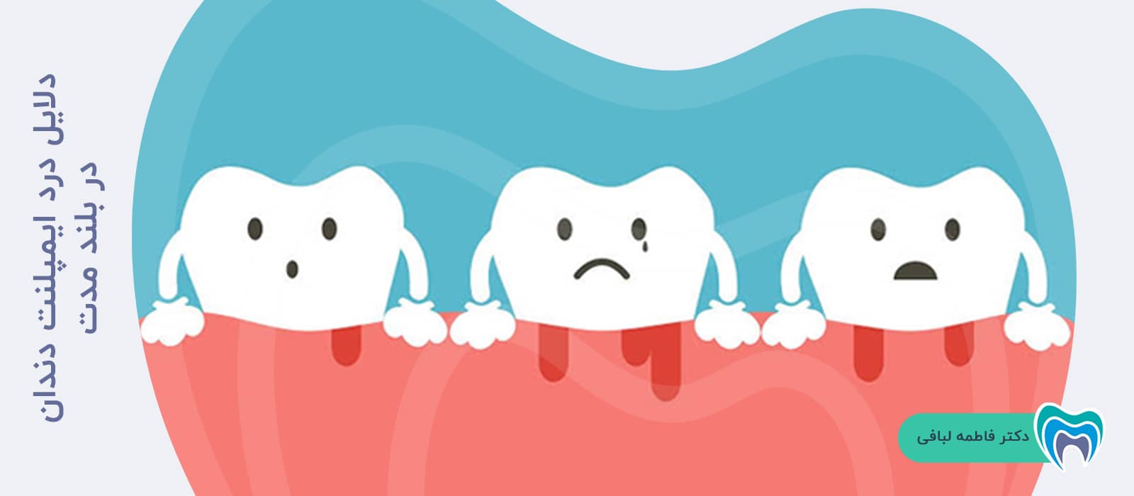 دلایل درد ایمپلنت دندان در بلند مدت