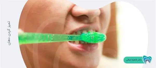 تمیز کردن دهان برای کاهش درد دندان