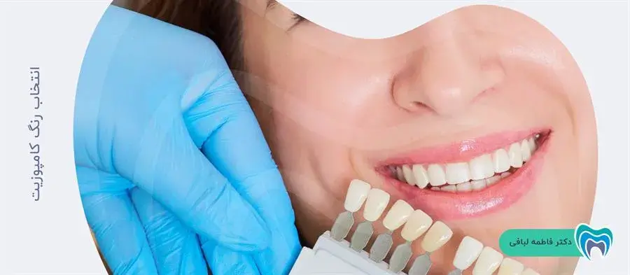 رنگ کامپوزیت دندان چگونه انتخاب می شود؟