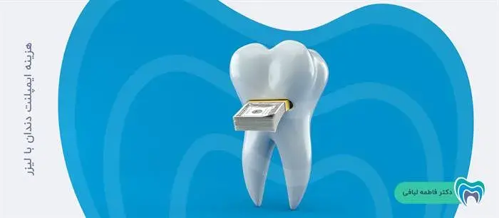 هزینه ایمپلنت دندان با لیزر