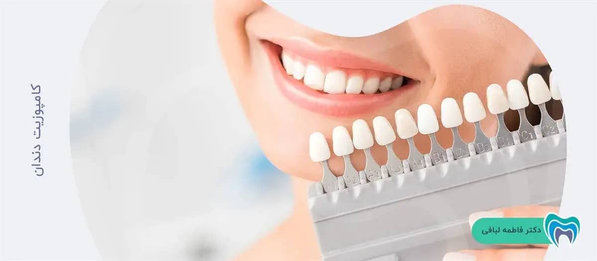 کامپوزیت برای سفید کردن دندان افراد سیگاری
