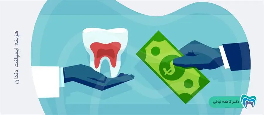 انجام ایمپلنت دندان چقدر هزینه خواهد داشت؟