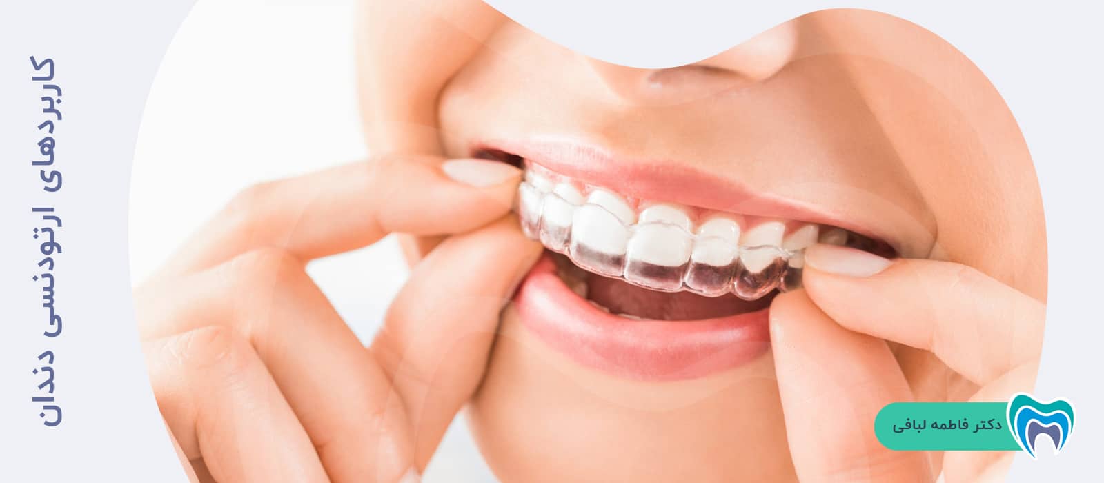 کاربردهای ارتودنسی دندان