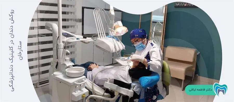 روکش دندان در کلینیک دندانپزشکی ستارخان