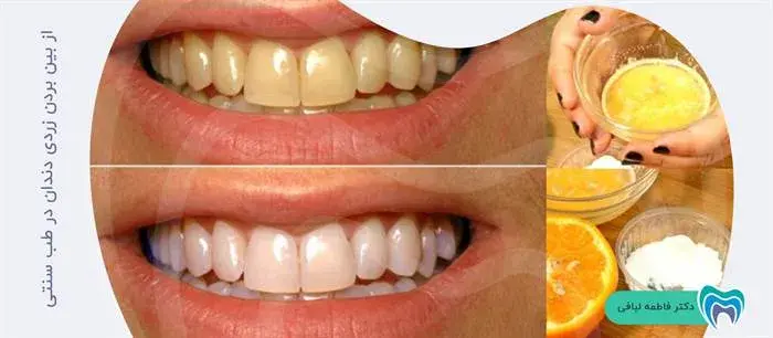 چگونه می‌توان با طب سنتی زردی دندان را از بین برد؟