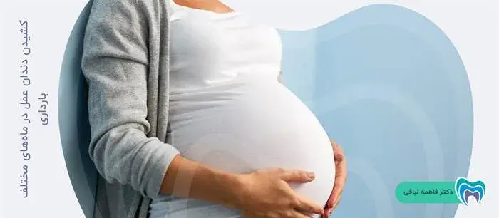 بهترین زمان برای کشیدن دندان عقل در بارداری در چند ماهگی حاملگی است؟