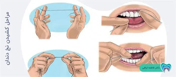 مراحل کشیدن نخ دندان
