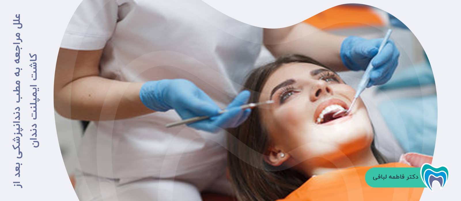 علل مراجعه به مطب دندانپزشکی بعد از کاشت ایمپلنت دندان