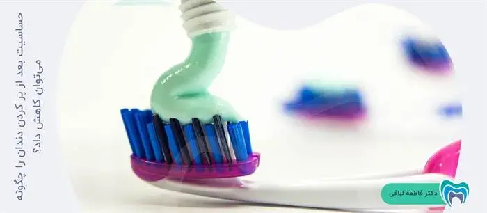 روش‌های کاهش حساسیت دندان بعداز پر کردن آن