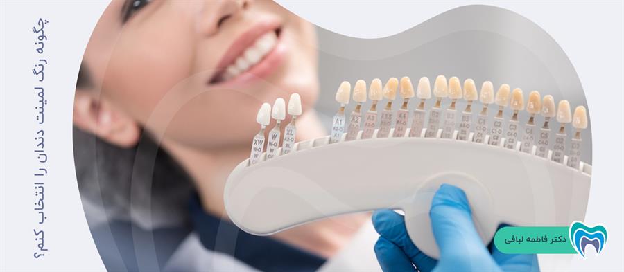 رنگ لمینت دندان را چگونه میتوان انتخاب کرد؟