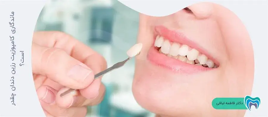 آیا کامپوزیت رزین دندان ماندگاری بالایی دارد؟