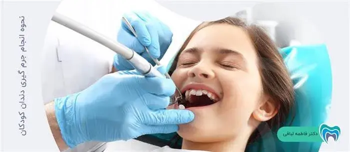 جرم گیری دندان کودک چگونه انجام می گیرد؟
