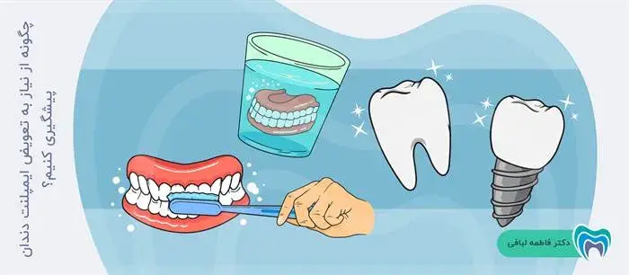 نحوه پیشگیری از تعویض ایمپلنت دندان 