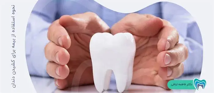 استفاده از بیمه برای کشیدن دندان چگونه است؟