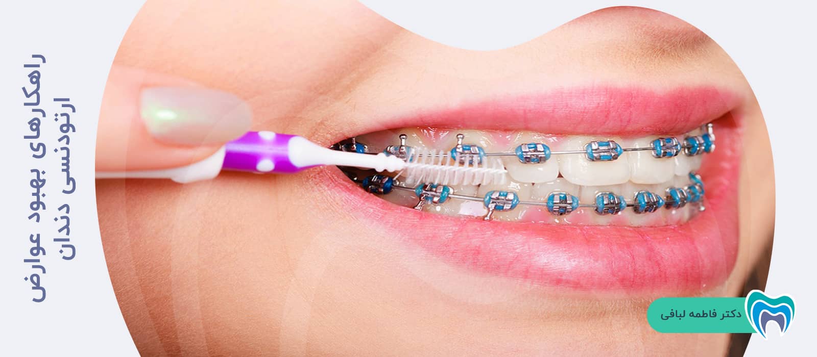 راهکارهای بهبود عوارض ارتودنسی دندان