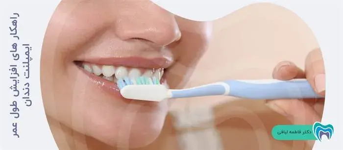 راهکار های افزایش طول عمر ایمپلنت دندان