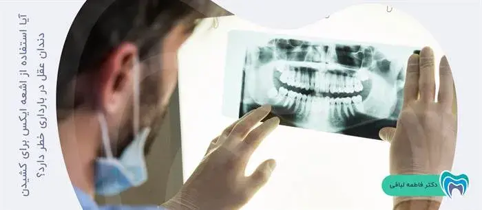 آیا می‌توان از اشعه ایکس برای کشیدن دندان عقل در باردرای استفاده کرد؟