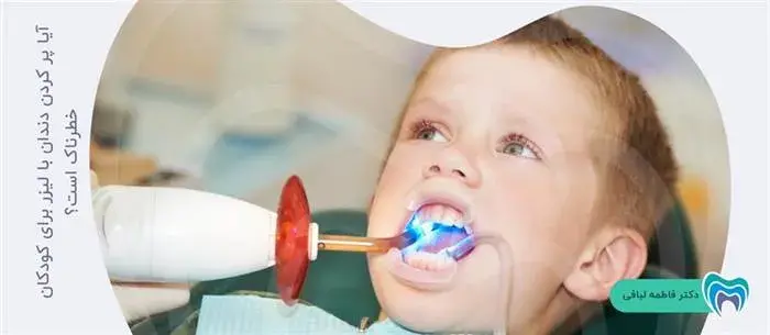 پر کردن دندان کودکان با لیزر