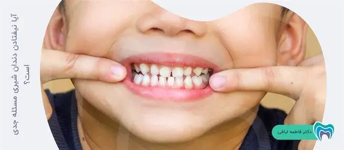آیا نیفتادن دندان شیری مسئله جدی است؟