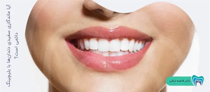 آیا بلیچینگ دندان تاثیری دائمی دارد؟