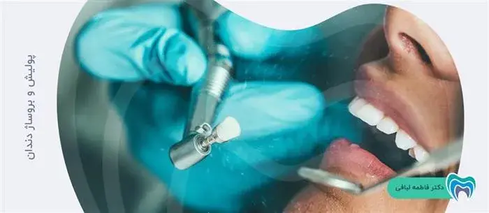 پولیش و بروساژ دندان، دو روش موثر برای دندانها