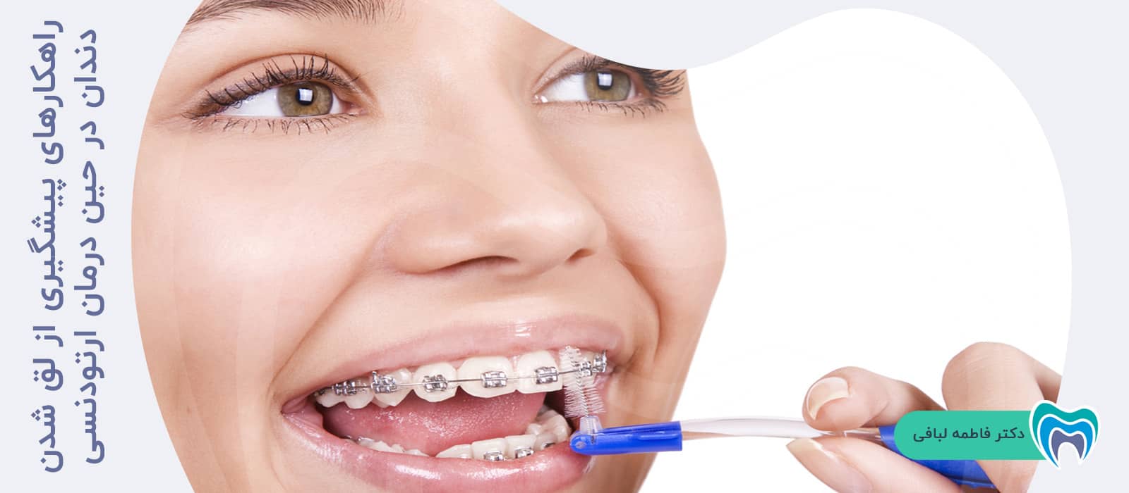 راهکارهای پیشگیری از لق شدن دندان در حین درمان ارتودنسی