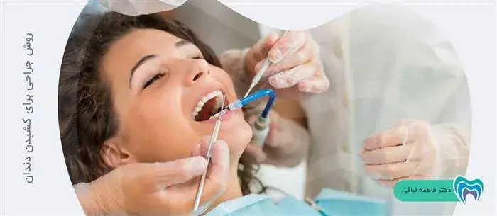 کشیدن دندان با جراحی چگونه انجام می شود؟