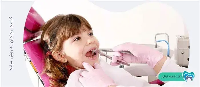 کشیدن دندان شیری با چه روشی انجام می شود؟