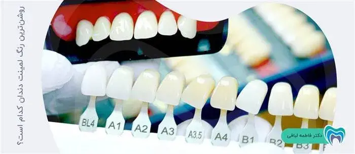 روشن ترین رنگ لمینت سرامیکی دندان
