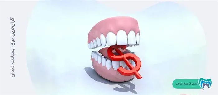 گران‌ترین نوع ایمپلنت دندان