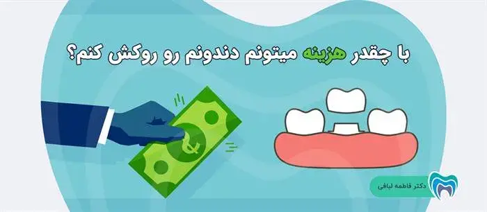 قیمت روکش دندان چقدر است؟