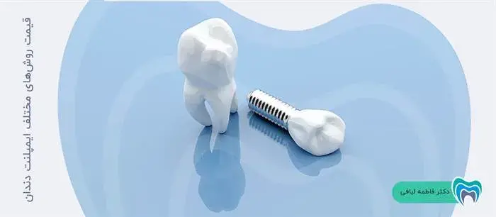 قیمت روش‌های مختلف ایمپلنت دندان