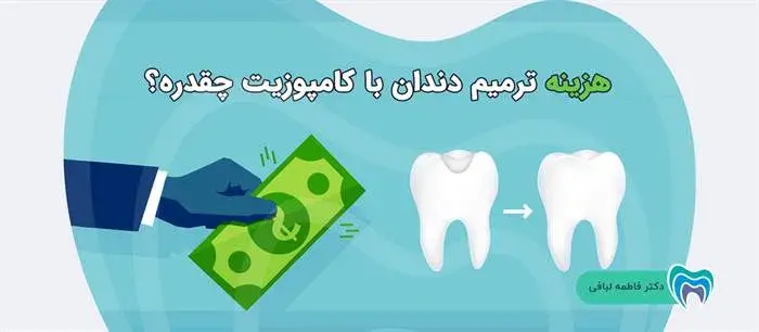 قیمت پر کردن دندان با کامپوزیت چقدر است؟