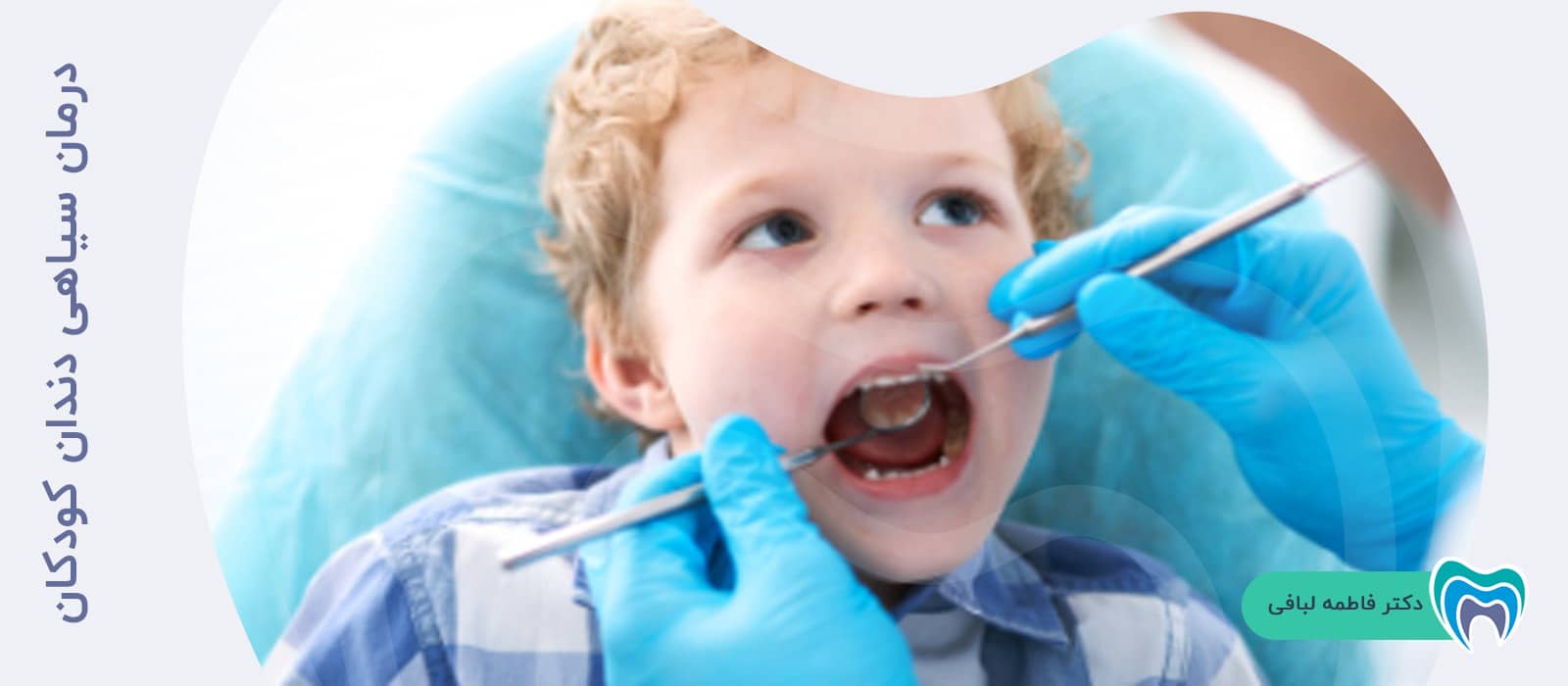 درمان سیاهی دندان کودکان