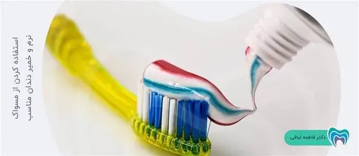 از خمیر دندان مخصوص لمینت استفاده کنید