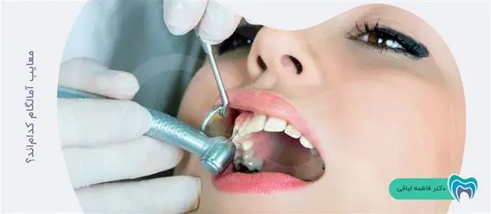 آمالگام دندان چه معایبی دارد؟