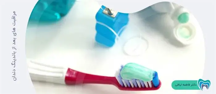 نحوه مراقبت از باندینگ دندان چگونه است؟
