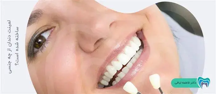 جنس لمینت دندان چیست؟