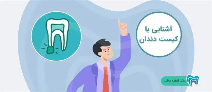 راهنمای جامع کیست دندان 