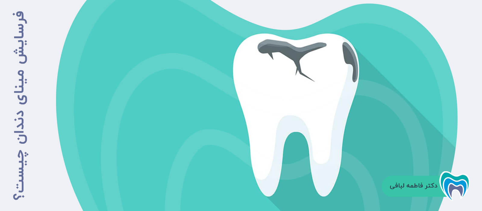 فرسایش مینای دندان چیست؟