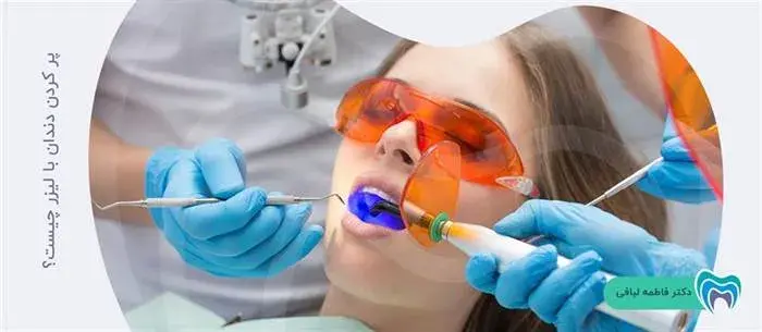 کاربرد لیزر در پر کردن دندان چیست؟