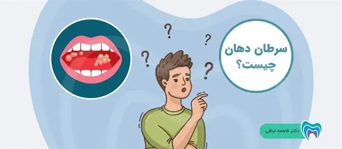 سرطان دهان چیست؟