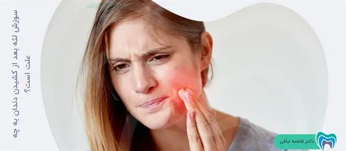 علت سوزش لثه بعد از کشیدن دندان