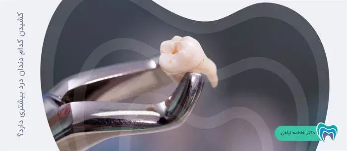 بیمار هنگام کشیدن کدام دندان درد بیشتری را احساس می‌کند؟